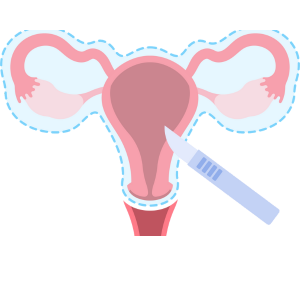 Laparoscopic Hysterectomy (Uterus Removal)