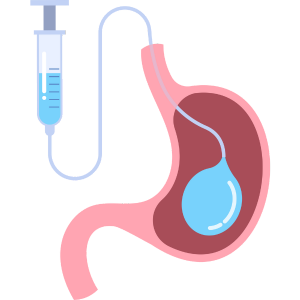 Laparoscopic Appendectomy